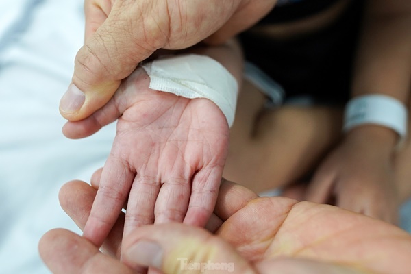 Vào điểm nóng đang điều trị hàng trăm trẻ mắc tay chân miệng ở TPHCM-3