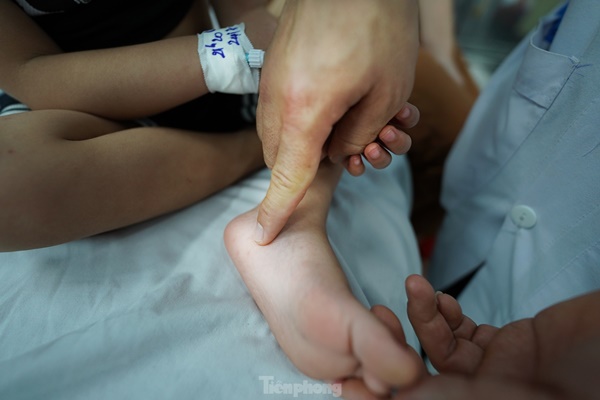 Vào điểm nóng đang điều trị hàng trăm trẻ mắc tay chân miệng ở TPHCM-4