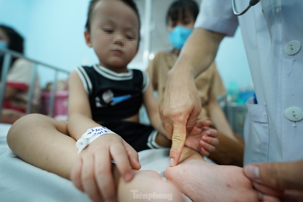 Vào điểm nóng đang điều trị hàng trăm trẻ mắc tay chân miệng ở TPHCM-5
