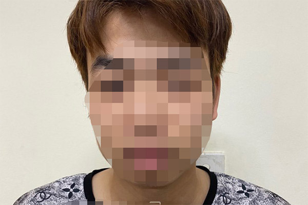 Vụ thông tin sai sự thật về bệnh nhân bị mổ lấy thận: Bệnh viện nói gì về vết thương ở bẹn?-2