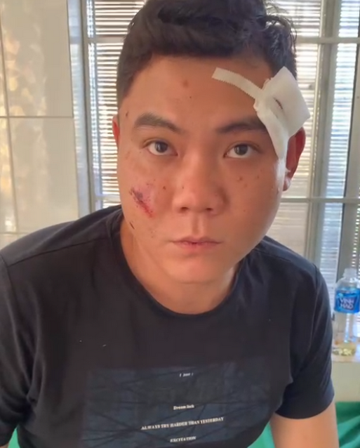 3 người bị thương sau vụ nổ súng trong đêm ở Khánh Hòa-2