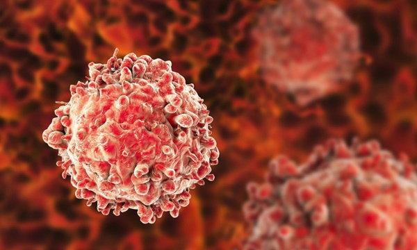 Đau ở 4 bộ phận này có thể là điềm báo ung thư, bác sĩ khuyến cáo không nên coi thường-1