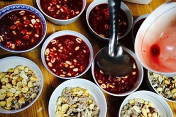 Chàng trai 22 tuổi vừa ngủ dậy đã điếc đột ngột vì thói quen người trẻ nào cũng từng làm-3