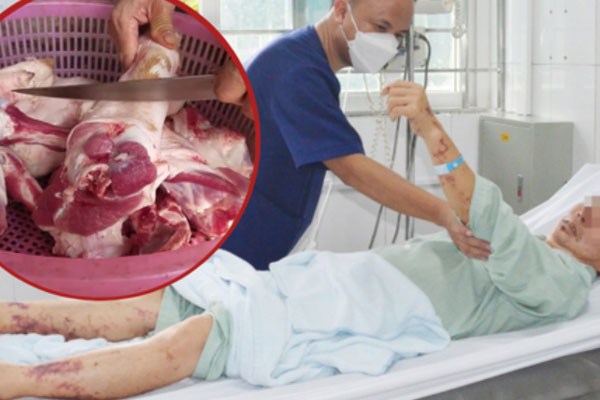 Có nên chần thịt qua nước sôi trước khi chế biến?-2