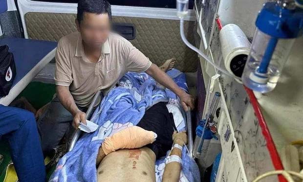 Sau tiếng nổ lớn, nam sinh lớp 12 bị dập nát bàn tay-1