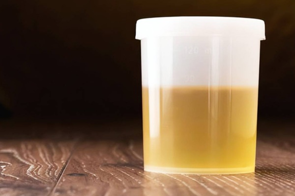 3 vàng trên cơ thể báo hiệu sức khoẻ bạn gặp vấn đề, cần gặp bác sĩ ngay-1