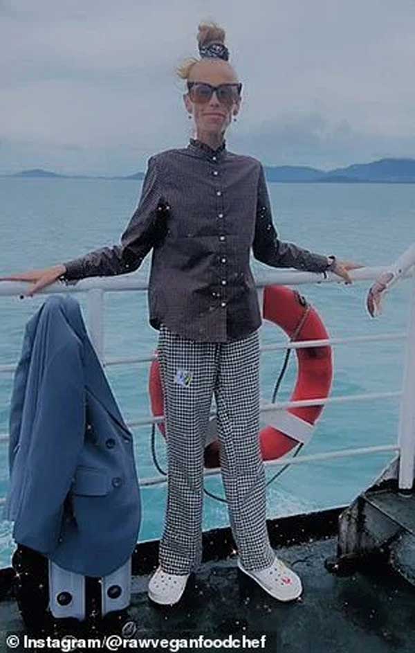 Những bức ảnh đáng sợ của nữ blogger tử vong sau khi ăn kiêng khắc nghiệt-1