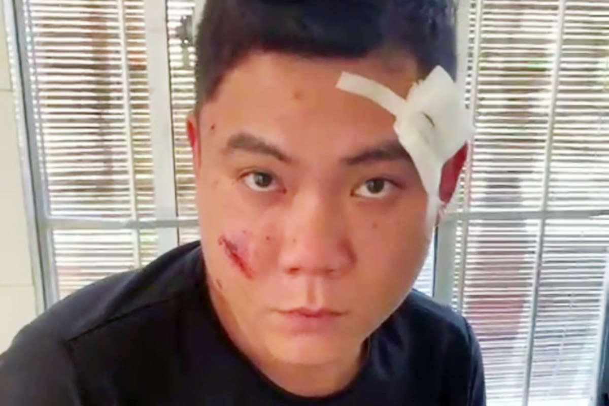 Khởi tố kẻ bắn trọng thương bố người tình-1