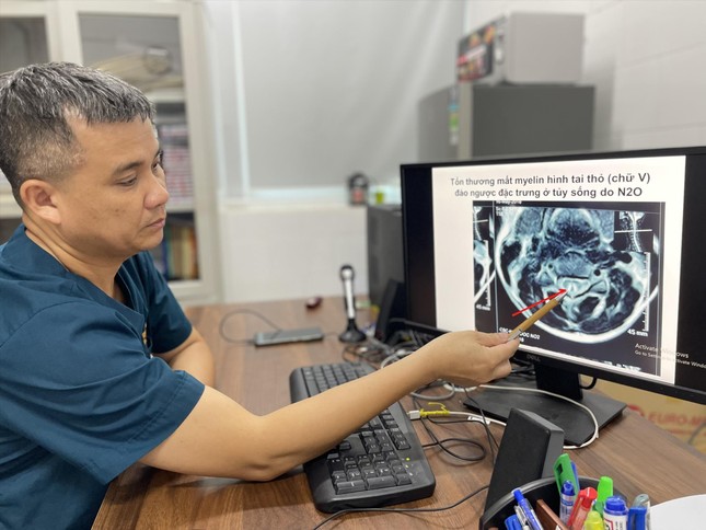 Hít bóng cười, người ra bã: Gây nghiện, làm tổn thương não và tủy sống-1