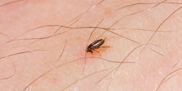 Người đàn ông bị cắt cụt bàn tay và chân do bọ chét cắn: Cảnh báo nguy cơ tiềm ẩn từ vật nuôi trong nhà-3