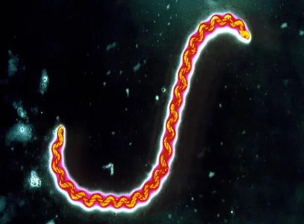 Nam thanh niên suy thận cấp, phải lọc máu do nhiễm xoắn khuẩn sau chuyến đi chơi thác-2