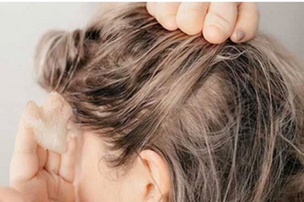 5 lợi ích khi dùng tẩy tế bào chết cho da đầu
