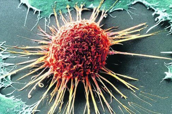 8 dấu hiệu cảnh báo khối u: Chuyên gia dặn có 1 cũng phải đi khám-1