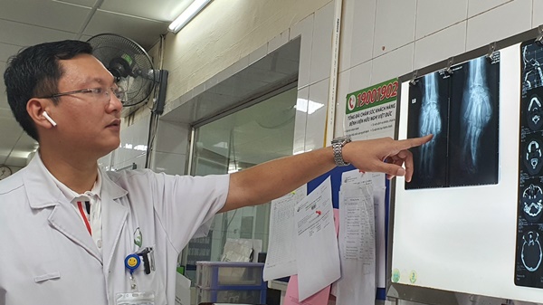 Mù mắt, cụt tay vì điện thoại phát nổ khi đang sạc-1