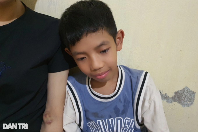 Mẹ suy thận giai đoạn cuối cầu xin cứu con trai mắc bệnh tim nặng-2