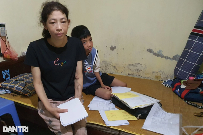 Mẹ suy thận giai đoạn cuối cầu xin cứu con trai mắc bệnh tim nặng-4