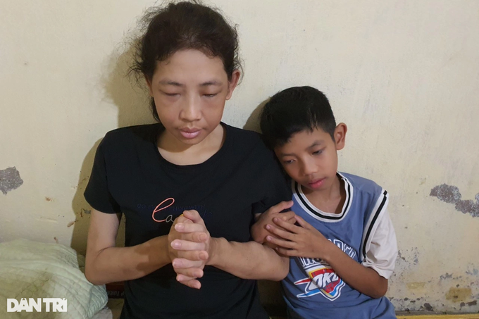 Mẹ suy thận giai đoạn cuối cầu xin cứu con trai mắc bệnh tim nặng-5