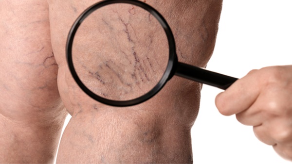 Căn bệnh khiến Trấn Thành vắng bóng truyền hình là bệnh gì, triệu chứng ra sao?-1