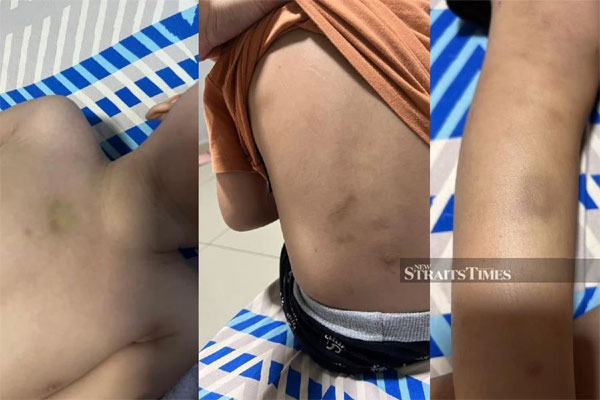 Cô giáo mầm non bạo hành học sinh, không ngờ đến cơn thịnh nộ ngút trời của gia đình nạn nhân-2