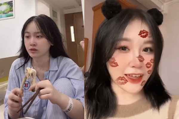 Hít bóng cười suốt 1 tháng, nam thanh niên bị tổn thương đa dây thần kinh-2