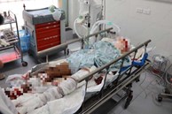 Vụ nổ bình gas ở Yên Phụ: Sức khỏe hai nạn nhân được điều trị tại Bệnh viện Bỏng quốc gia hiện ra sao?