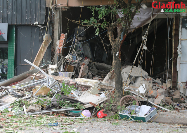 Vụ nổ bình gas ở Yên Phụ: Sức khỏe hai nạn nhân được điều trị tại Bệnh viện Bỏng quốc gia hiện ra sao?-1