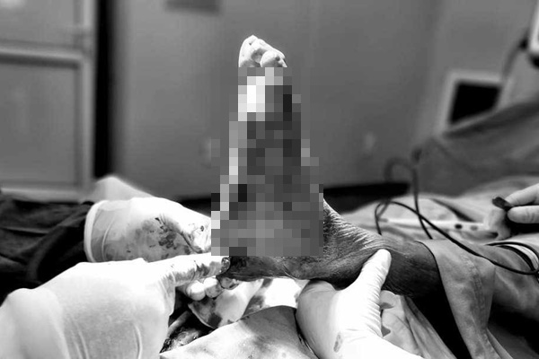 Mặt, chân biến dạng vì thói quen dùng thuốc nhiều người Việt mắc phải-1