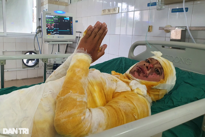 Cậu bé bắt chim trên đường dây điện cao thế thều thào Xin... cứu con-6