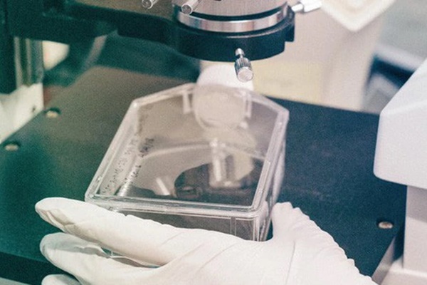 Bào thai mang đột biến gen hiếm gặp lần đầu tiên được phát hiện tại Việt Nam-1