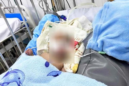 Bé trai 3 tháng tuổi tử vong nghi bị bạo hành: Bệnh viện Nhi Đồng 2 thông tin
