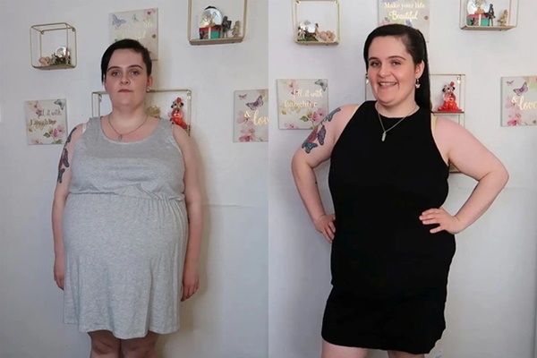 Tưởng mang thai, người phụ nữ không ngờ mình bị u nang buồng trứng nặng 16kg-2