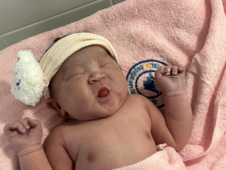 Em bé 3,7kg chào đời cùng vòng tránh thai của mẹ trong màng bánh nhau-2