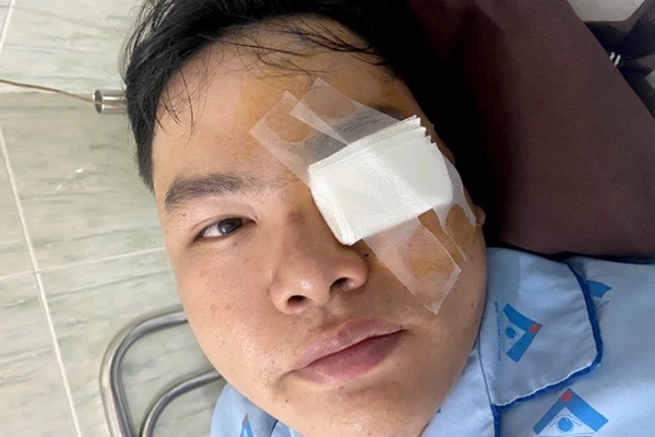 Xác minh vụ nam thanh niên tố bị gậy CSGT va vào mắt-2