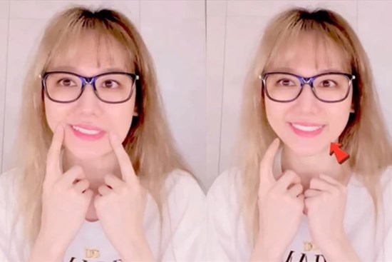 Hari Won từng bị liệt nửa mặt, tự ti không dám xuất hiện: Cảnh báo dấu hiệu bệnh và thời điểm dễ bị