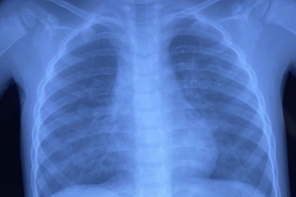 Bé 5 tuổi bị ngộ độc do uống nhầm chất tẩy rửa-1