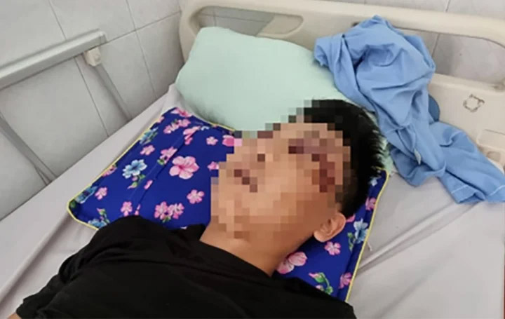 Lời khai của 3 kẻ côn đồ đánh bất tỉnh nam thanh niên trên quốc lộ ở Thanh Hóa-2