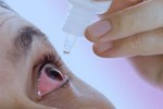 Dịch đau mắt đỏ lây lan rộng, cha mẹ nên làm tốt 5 nguyên tắc này để bảo vệ sức khỏe cho con-2