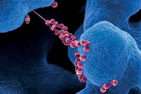 Người đàn ông tử vong chỉ sau 2 ngày sốt cao do nhiễm liên cầu lợn-2