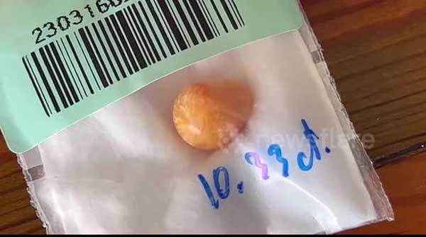 Mua ốc về nhậu, người đàn ông bất ngờ đổi đời nhờ nhặt được vật lạ màu cam-1