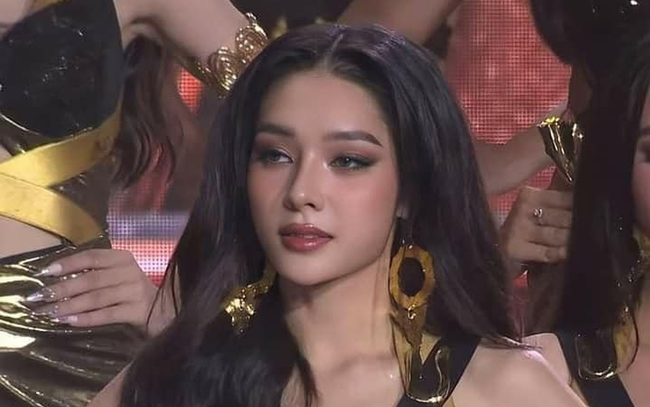 Á hậu Hồng Hạnh của Miss Grand Vietnam 2023: Sửa mũi, nhấn mí, tiêm filler để có nhan sắc chuẩn beauty queen-2