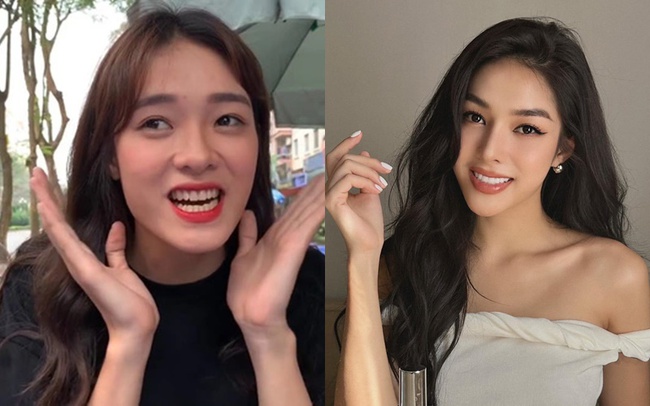 Á hậu Hồng Hạnh của Miss Grand Vietnam 2023: Sửa mũi, nhấn mí, tiêm filler để có nhan sắc chuẩn beauty queen-6