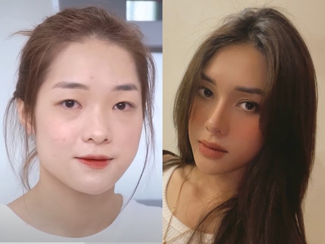 Á hậu Hồng Hạnh của Miss Grand Vietnam 2023: Sửa mũi, nhấn mí, tiêm filler để có nhan sắc chuẩn beauty queen-7