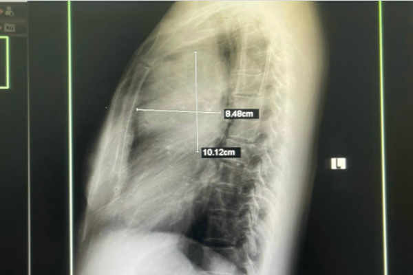 Phát hiện loại ung thư hàng vạn người Việt mắc chỉ bằng phương pháp rẻ tiền-1