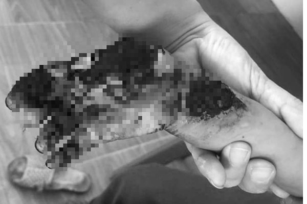 Cầm đầu dây sạc điện thoại, bé 3 tuổi bị giật cháy tay-1