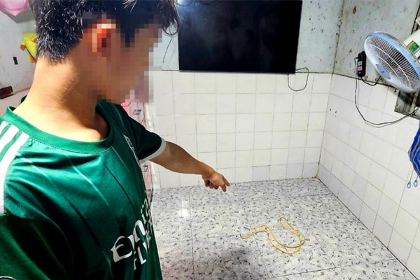 Tình trạng người phụ nữ bị chồng chích điện, đâm nhiều nhát-2