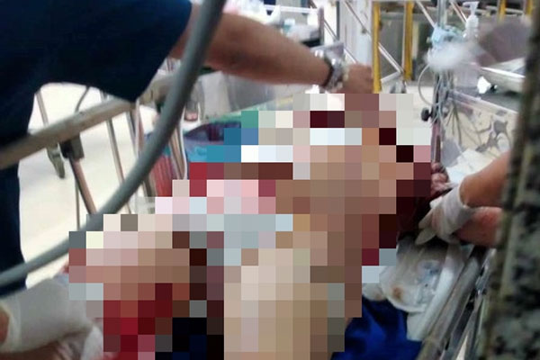 Tình trạng người phụ nữ bị chồng chích điện, đâm nhiều nhát-1