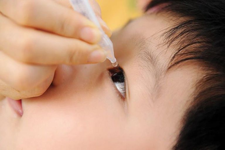Dịch đau mắt đỏ lây lan rộng, cha mẹ nên làm tốt 5 nguyên tắc này để bảo vệ sức khỏe cho con-1