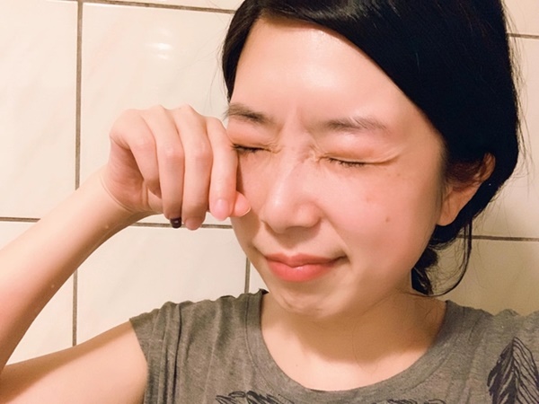 4 dấu hiệu cảnh báo ung thư trên đôi mắt ít ai để ý-1