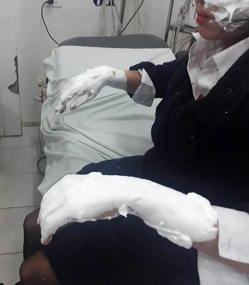 Bóng bay - Món đồ chơi cực kỳ nguy hiểm ít ai ngờ-4