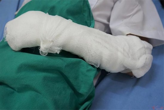 Hút thuốc lá gây nổ bóng bay tại lễ khai giảng: Yêu cầu kiểm điểm thầy giáo